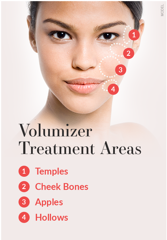 Graphic featuring woman's face and volumizer treatment areas