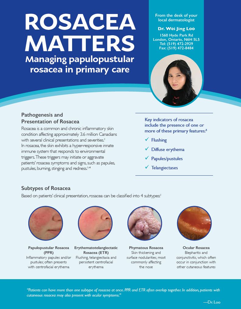 DermEffects rosacea newsletter cover